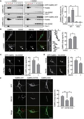 Lipidation states orchestrate CLICK-III/CaMKIγ's stepwise association with Golgi and rafts-enriched membranes and specify its functional coupling to STEF-Rac1-dependent neurite extension